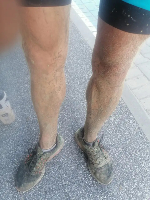 Ultrakolarz ze Skuszewa